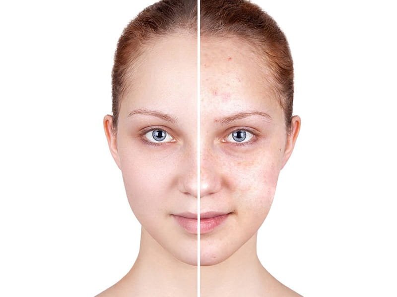 headshot photo retouching